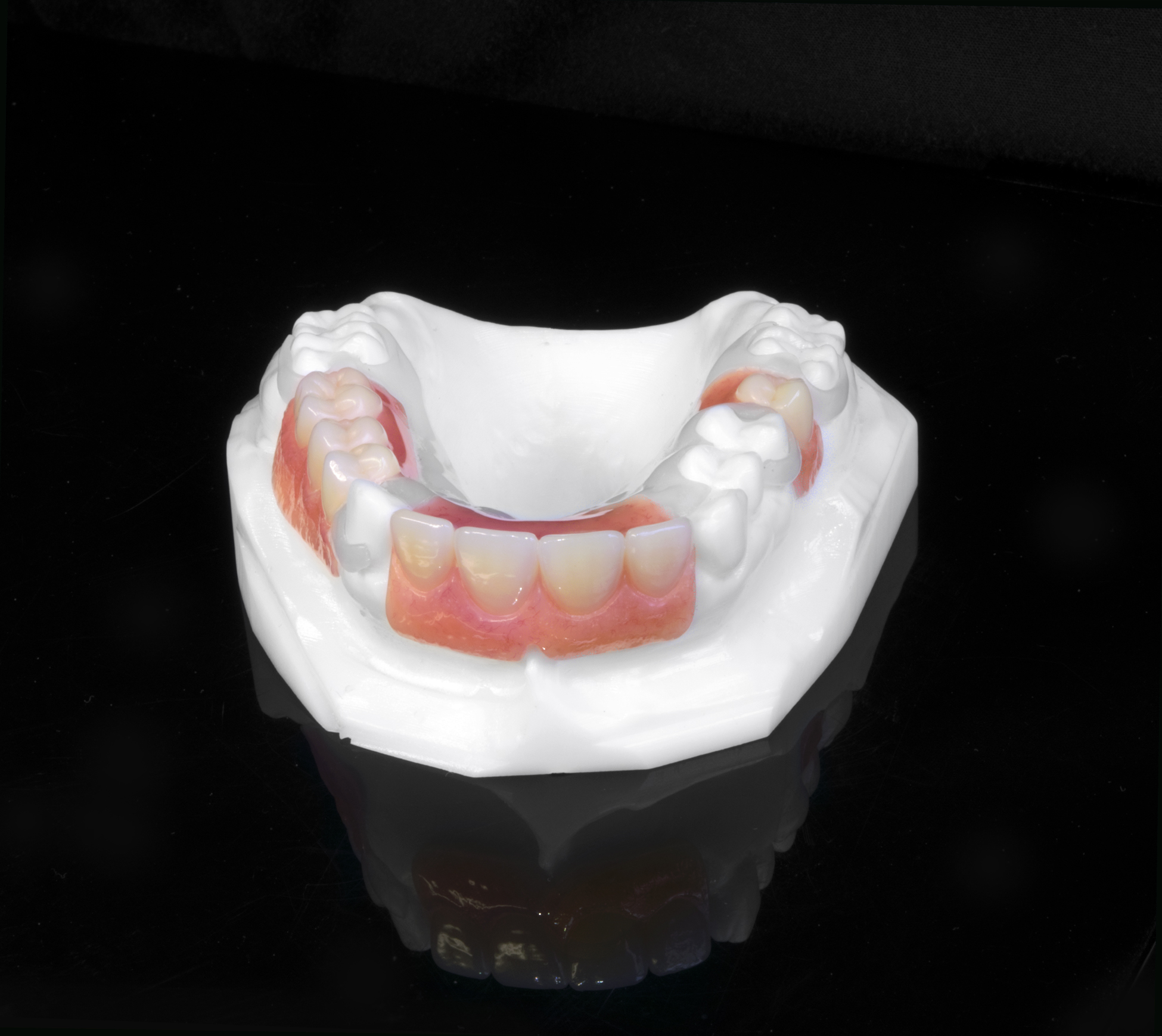 Visiclear Rpd VisiClear – Studio32 Dental Laboratory