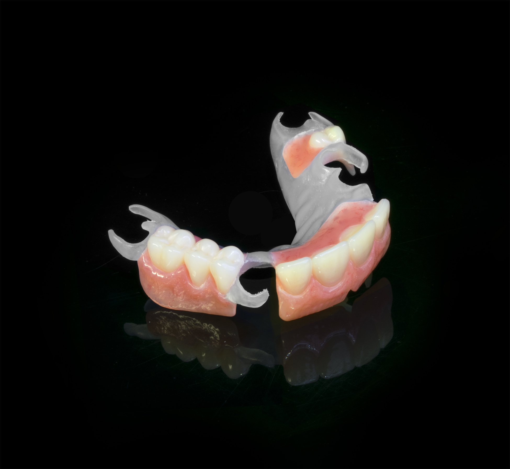 Visiclear Rpd VisiClear – Studio32 Dental Laboratory