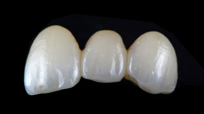 High Translucent Zirconia