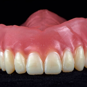 Digital Dentures